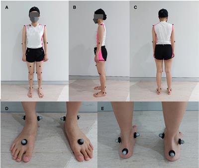 The ankle kinematic reference of normal gait pattern in Thai adults